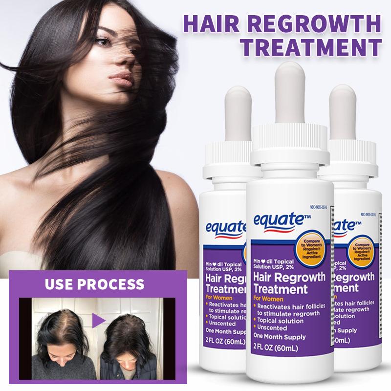 Women s Fast Hair Growth Essence Spray for Natural Tunisia Ubuy